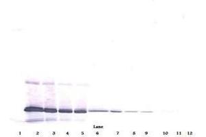 Image no. 4 for anti-Interleukin 11 (IL11) antibody (ABIN465144) (IL-11 Antikörper)