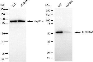 Western blotting analysis using ALDH1A1 antibody (ABIN7797555).