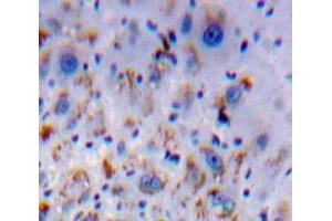 Immunohistochemistry (IHC) image for anti-Hemochromatosis Type 2 (Juvenile) (HFE2) (AA 29-401) antibody (ABIN1859170)