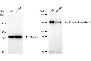Western blotting analysis using Histone deacetylase 9 antibody (ABIN7798938). (Rekombinanter HDAC9 Antikörper)