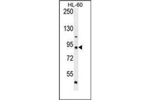 Western blot analysis of KIAA1586 Antibody (N-term) Cat. (KIAA1586 Antikörper  (N-Term))