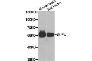Western blot analysis of extracts of various cell lines, using SUFU antibody (ABIN5974087) at 1/1000 dilution.
