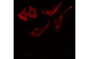 ABIN6274866 staining Hela cells by IF/ICC. (Arylsulfatase E Antikörper  (Internal Region))