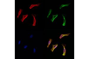 ABIN6261469 and ABIN6278061 staining Hela cells by IF/ICC.