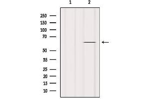 Western blot analysis of extracts from Hela, using TAIP-2 Antibody. (CSRNP3 Antikörper  (Internal Region))