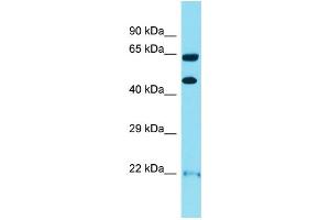 WB Suggested Anti-OPRK1 Antibody Titration:  1 ug/ml  Positive Control:  HuFetal Kidney (OPRK1 Antikörper  (N-Term))