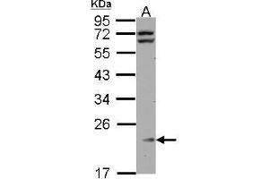 WB Image Sample (30 ug of whole cell lysate) A: HeLa 12% SDS PAGE antibody diluted at 1:1000 (RPL11 Antikörper)