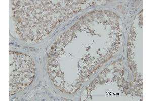 Immunoperoxidase of monoclonal antibody to MAP3K4 on formalin-fixed paraffin-embedded human testis. (MAP3K4 Antikörper  (AA 1201-1300))