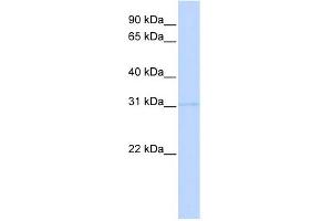 WB Suggested Anti-PRMT6 Antibody Titration:  0. (PRMT6 Antikörper  (Middle Region))
