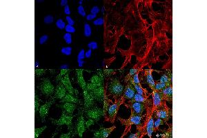 Immunocytochemistry/Immunofluorescence analysis using Rabbit Anti-UVRAG Polyclonal Antibody . (UVRAG Antikörper  (PE))