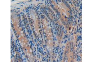 Used in DAB staining on fromalin fixed paraffin- embedded intestine tissue (CDKN2B Antikörper  (AA 1-130))