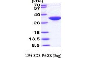 Inositol(myo)-1(or 4)-Monophosphatase 1 (IMPA1) (AA 1-277) protein (His tag)