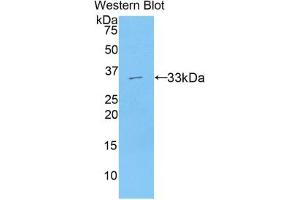 Western blot analysis of the recombinant protein. (AXIN2 Antikörper  (AA 350-631))