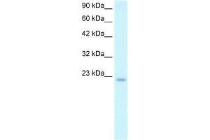 Human Daudi; WB Suggested Anti-POLE3 Antibody Titration: 2. (POLE3 Antikörper  (N-Term))