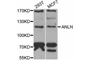 Western blot analysis of extracts of various cell lines, using ANLN antibody (ABIN5973909) at 1/1000 dilution. (Anillin Antikörper)