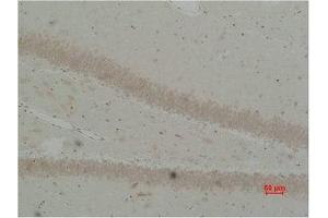 Immunohistochemical analysis of paraffin-embedded Rat Brain Tissue using BEST2 Polyclonal Antibody. (Bestrophin 2 Antikörper)