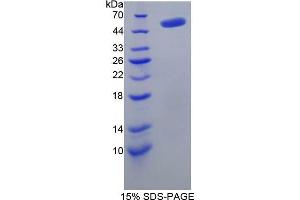 SDS-PAGE analysis of Rat TP Protein. (Thymidine Phosphorylase Protein (TYMP))