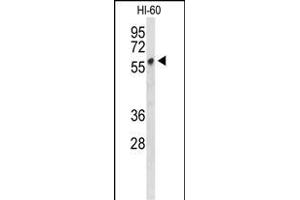 Western blot analysis of PLV Antibody (Center) 9378c in HL-60 cell line lysates (35 μg/lane). (PLVAP Antikörper  (AA 214-242))