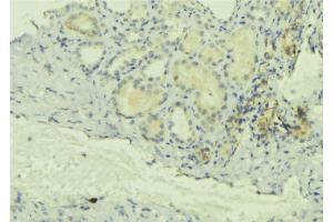 ABIN6277709 at 1/100 staining Mouse kidney tissue by IHC-P. (Chloride Channel 5 Antikörper  (Internal Region))