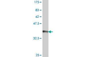 Western Blot detection against Immunogen (36. (IL3RA Antikörper  (AA 19-109))