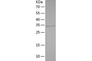 MAP1D Protein (AA 20-335) (His tag)