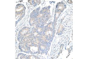 Immunohistochemistry (IHC) image for anti-Notch 1 (NOTCH1) (AA 2505-2555) antibody (ABIN7454790) (Notch1 Antikörper  (AA 2505-2555))