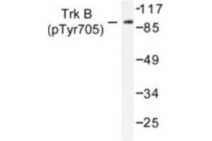 Image no. 1 for anti-Neurotrophic Tyrosine Kinase, Receptor, Type 2 (NTRK2) (pTyr705) antibody (ABIN318147) (TRKB Antikörper  (pTyr705))