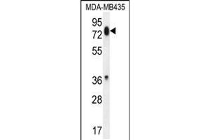 Western blot analysis in MDA-MB435 cell line lysates (35ug/lane). (PCDHB13 Antikörper  (AA 273-300))