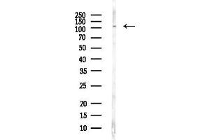 Western blot analysis of lysates from PC12 cells(LPS, 4h treatment), using Integrin alpha4 Antibody at 1/1000 dilution.
