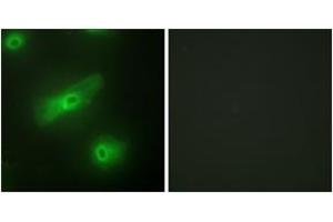 Immunofluorescence analysis of HeLa cells, using TALL-2 Antibody. (TNFSF13 Antikörper  (AA 151-200))