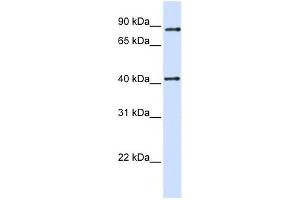 TXNDC13 antibody used at 1 ug/ml to detect target protein. (TMX4 Antikörper  (C-Term))