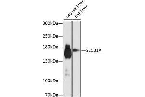 Western blot analysis of extracts of various cell lines, using SEC31A antibody (ABIN6132940, ABIN6147491, ABIN6147492 and ABIN6224974) at 1:1000 dilution. (SEC31A Antikörper  (AA 300-500))