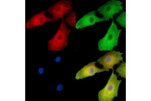 ABIN7096260 and ABIN7100322 staining  cells by IF/ICC. (Ubiquinol-Cytochrome C Reductase Complex Chaperone (UQCC) Antikörper)