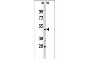 Western blot analysis of DCP2 Antibody (Center) (ABIN653129 and ABIN2842708) in HL-60 cell line lysates (35 μg/lane). (DCP2 Antikörper  (AA 144-173))