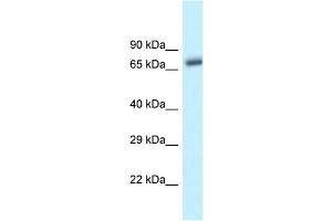 WB Suggested Anti-Btrc Antibody   Titration: 1. (BTRC Antikörper  (C-Term))