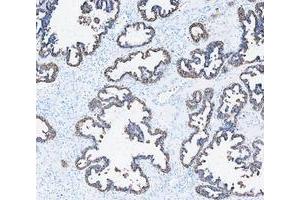 IHC analysis of Cytokeratin 8/KRT8 using anti-Cytokeratin 8/KRT8 antibody (ABIN5518853). (KRT8 Antikörper  (AA 107-325))