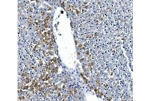 IHC analysis of IRAK2 using anti-IRAK2 antibody (ABIN7602761).