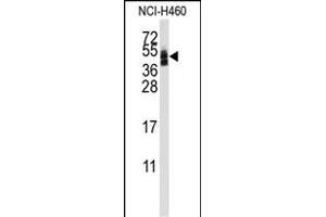 Western blot analysis of anti-CXADR Antibody (Center) (ABIN389372 and ABIN2839469) in NCI- cell line lysates (35 μg/lane).