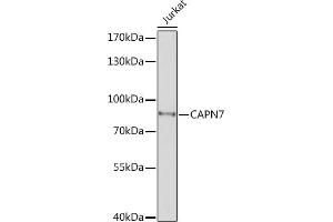 Western blot analysis of extracts of Jurkat cells, using C Rabbit pAb (ABIN7266034) at 1:1000 dilution. (Calpain 7 Antikörper  (AA 20-220))