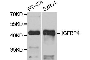 Western blot analysis of extracts of various cell lines, using IGFBP4 antibody (ABIN5971049) at 1/1000 dilution.