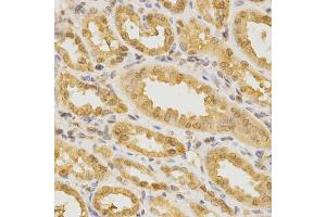 Immunohistochemistry of paraffin-embedded human kidney using CDC42 Antibody (ABIN5970534) at dilution of 1/200 (40x lens). (CDC42 Antikörper)