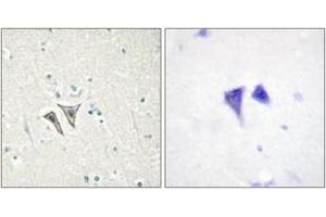 Immunohistochemistry (IHC) image for anti-Activin Receptor Type 1C (ACVR1C) (AA 201-250) antibody (ABIN2889678) (ACVR1C/ALK7 Antikörper  (AA 201-250))