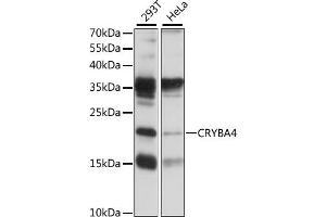 Western blot analysis of extracts of various cell lines, using CRYB antibody (ABIN7266530) at 1:1000 dilution. (CRYbA4 Antikörper  (AA 1-196))