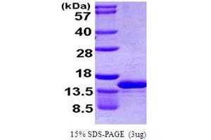 SDS-PAGE (SDS) image for Chemokine (C-C Motif) Ligand 4-Like 1 (CCL4L1) (AA 24-92) protein (His tag) (ABIN666795)
