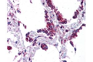 SFTPC antibody was used for immunohistochemistry at a concentration of 4-8 ug/ml. (Surfactant Protein C Antikörper  (N-Term))
