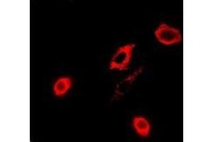 Immunofluorescent analysis of GPx-4 staining in A549 cells.