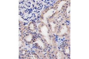 (ABIN655076 and ABIN2844708) staining HTR2B in human kidney tissue sections by Immunohistochemistry (IHC-P - paraformaldehyde-fixed, paraffin-embedded sections). (Serotonin Receptor 2B Antikörper  (C-Term))
