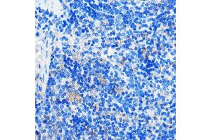 Immunohistochemistry of paraffin-embedded Mouse spleen using HC Rabbit pAb (ABIN7267805) at dilution of 1:100 (40x lens). (GPR109B Antikörper)
