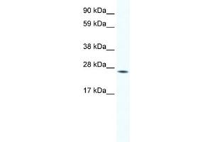 WB Suggested Anti-HOXB7 Antibody Titration:  1. (HOXB7 Antikörper  (Middle Region))