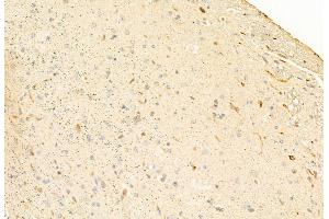 ABIN6262701 and ABIN6269060 at 1/100 staining Mouse brain tissue by IHC-P. (JAK2 Antikörper  (C-Term))